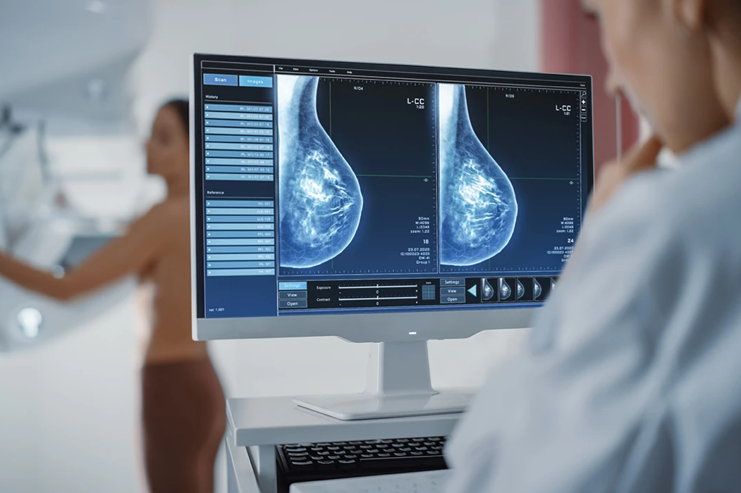 Mammography - ORHUN MEDICAL