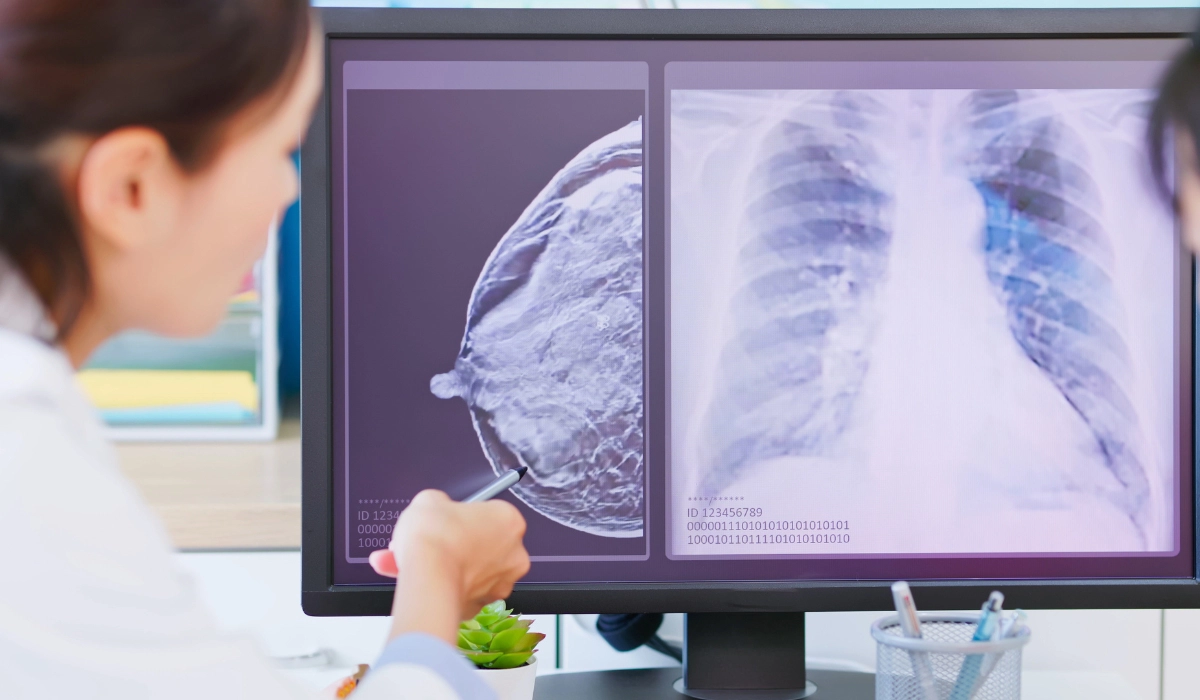 MAMMOLOGY Orhun Medical